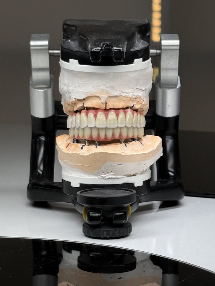 Mastering the First Impression: Your intriguing post title goes here Realistic dental model on articulator, ideal for dental lab demonstrations.