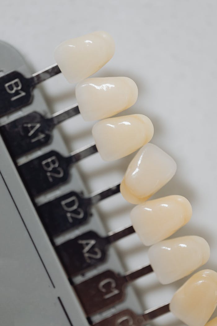 The Art of Drawing Readers In: Your attractive post title goes here High-quality image of a dental veneers shade guide used in dentistry.